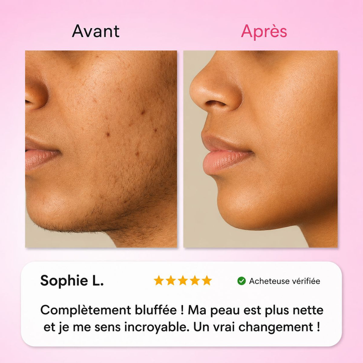 Névéa - Le premier kit complet en 3 étapes