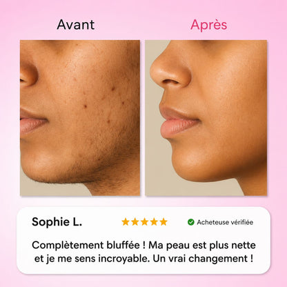 Névéa - Le premier kit complet en 3 étapes