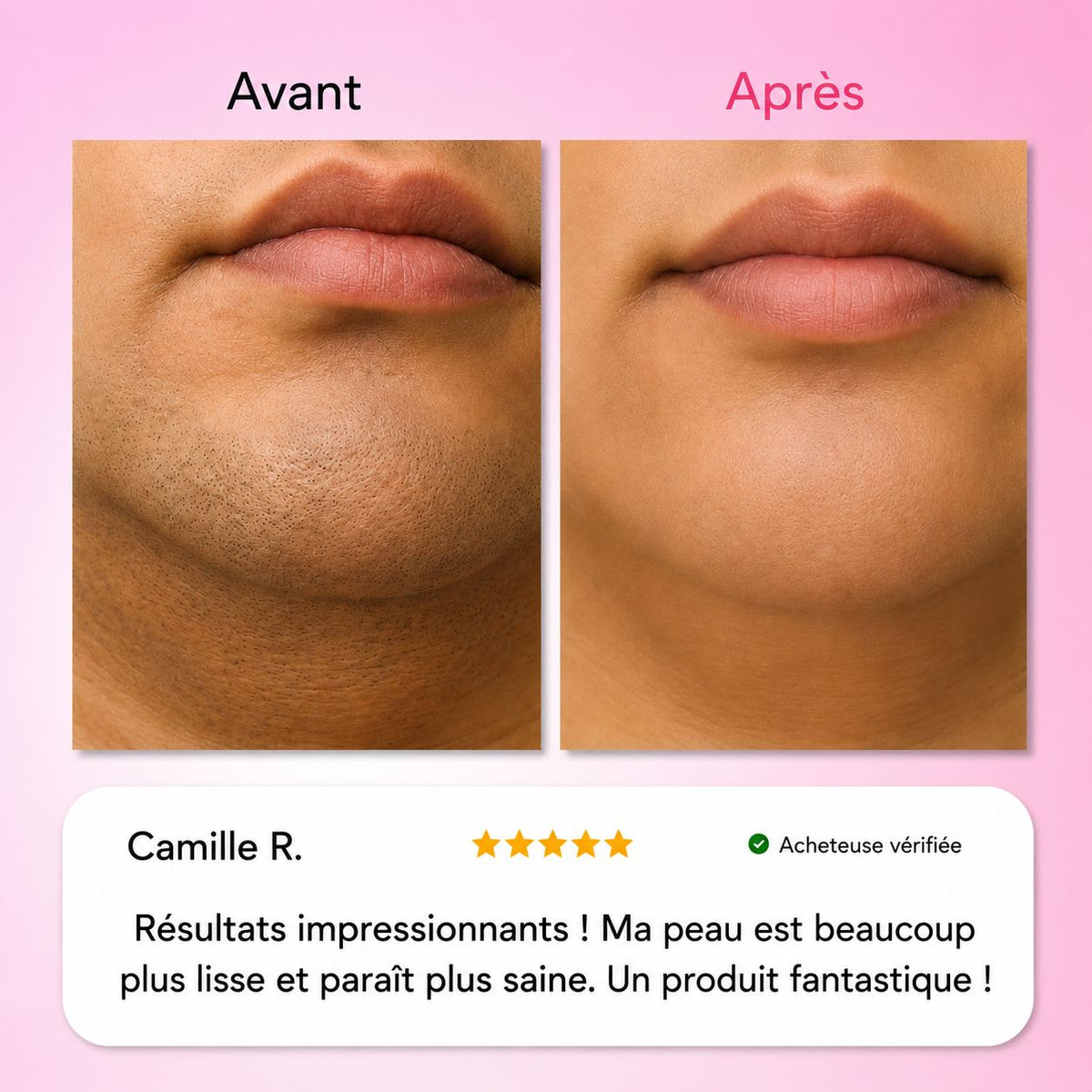 Névéa - Le premier kit complet en 3 étapes