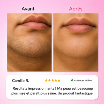 Névéa - Le premier kit complet en 3 étapes