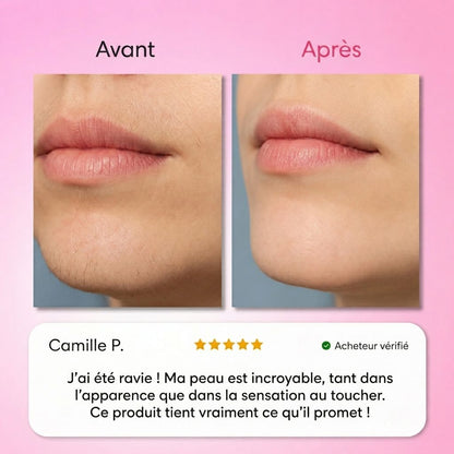 Névea - Le premier kit complet en 3 étapes qui affaiblit et dissout les poils hormonaux, sans douleur ni irritation.