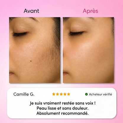 Névea - Le premier kit complet en 3 étapes qui affaiblit et dissout les poils hormonaux, sans douleur ni irritation.