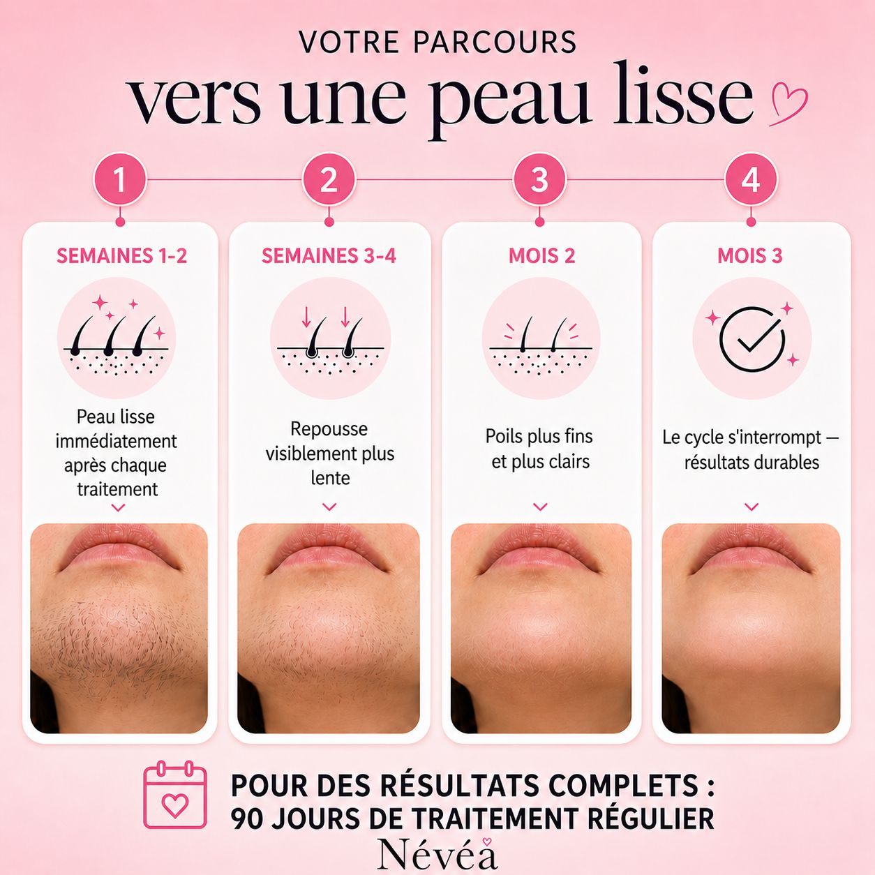 Névea - Le premier kit complet en 3 étapes qui affaiblit et dissout les poils hormonaux, sans douleur ni irritation.