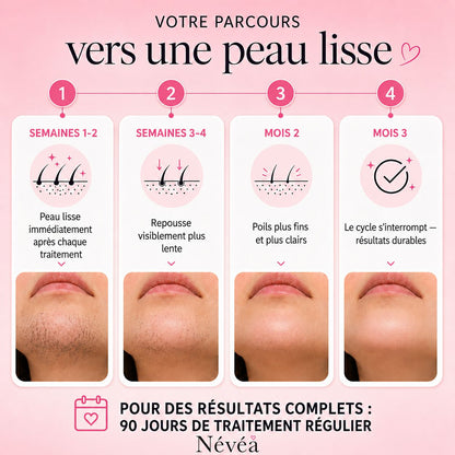 Névea - Le premier kit complet en 3 étapes qui affaiblit et dissout les poils hormonaux, sans douleur ni irritation.